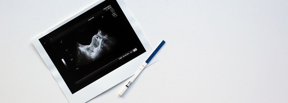 Can I Still Get My Partner Pregnant After a Vasectomy?